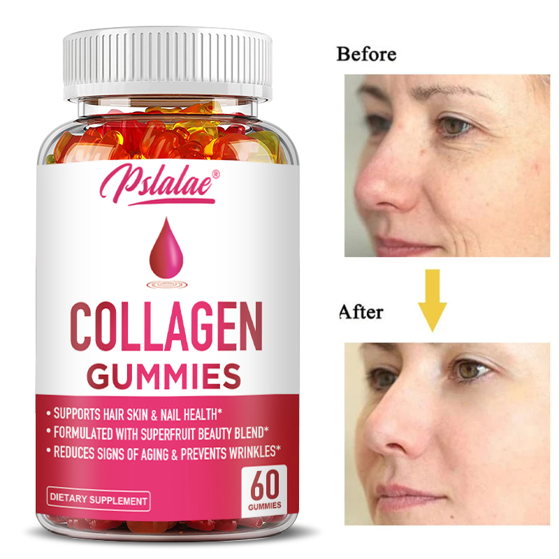Collagen Gummies - for Overall - Health Wellness Gummies recensione e prezzo